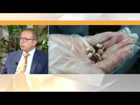 لايف ستايلبالفيديو: الإكثار من الماء يجنّبك التعرّض إلى حصى الكلى11875/0