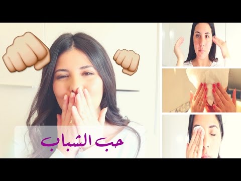 لايف ستايلبالفيديو: كيفية تفادي حب الشباب وطريقة التخلُّص منه45162/0