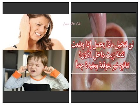لايف ستايلشاهد: وصفة رائعة لالتهاب الأذن وبمكون واحد فقط45703/0