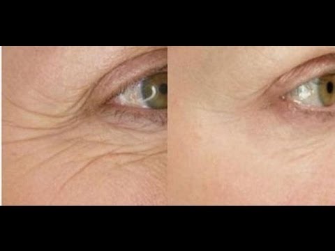 لايف ستايلشاهد: الخلطة الرهيبة ستجعلك تبدين أصغر بعشر أعوام45708/0