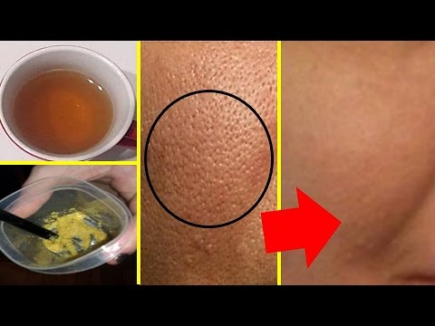 لايف ستايلبالفيديو: قناع ينصح به الاطباء لإخفاء المسام الواسعة من استعمال واحد45893/0