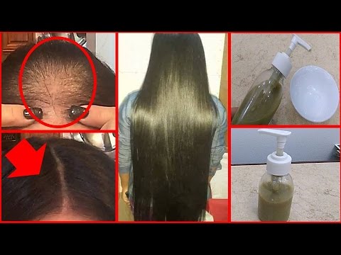 لايف ستايلبالفيديو: أفضل وصفة للقشرة وتساقط الشعر45895/0