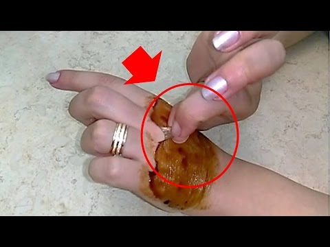 لايف ستايلبالفيديو: أفضل وصفة لعلاج اسمرار البشرة45898/0