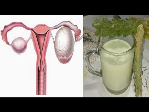 لايف ستايلشاهد: وصفة مضمونة لعلاج تكيس المبيض46508/0