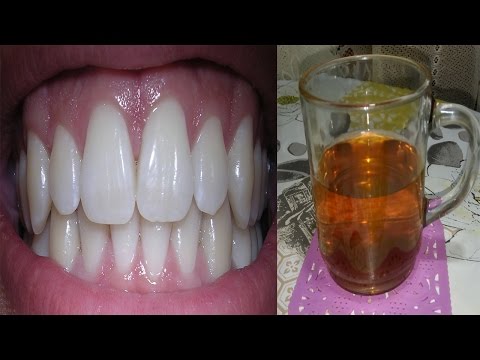 لايف ستايلشاهد: طرق الحصول على لثة وردية بدون إلتهاب46517/0