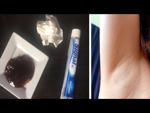 لايف ستايلشاهد: التخلص من شعر الجسم بدون ألم نهائيًا46701/0