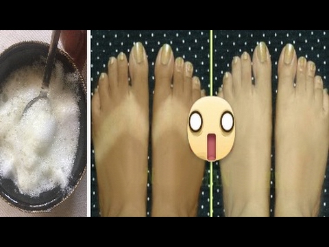 لايف ستايلشاهد: وصفة للتخلص من الأماكن الداكنة في الجسم46703/0