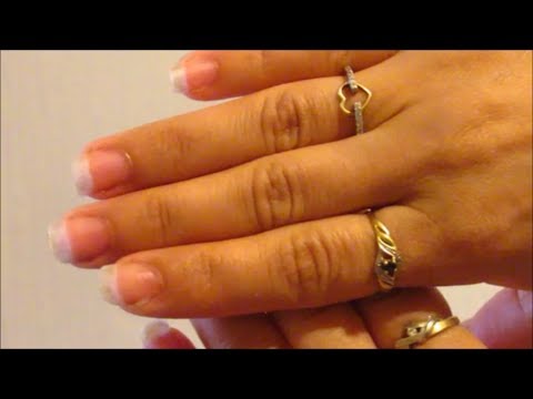 لايف ستايلشاهد: طريقة فعالة لمعالجة إصفرار الأظاهر46904/0