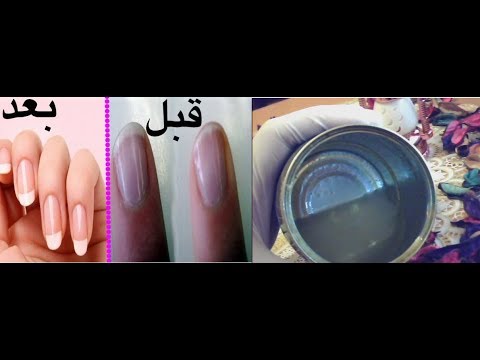 لايف ستايلشاهد: تطويل الأظافر وتقويتها والتخلص من الفطريات بمكون واحد فقط47344/0