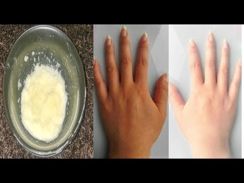 لايف ستايلشاهد| وصفة سحرية لتبييض وتفتيح اليدين47744/0