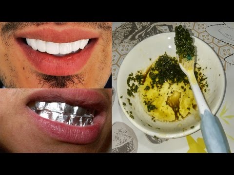 لايف ستايلشاهد| وصفة سحرية تجعل أسنانكِ بيضاء كاللؤلؤ47748/0