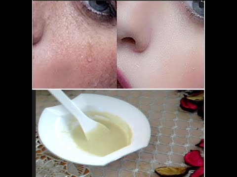 لايف ستايلشاهد| وصفة سحرية لبشرتك ومفعولها من أول استعمال47914/0