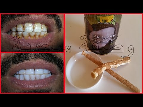 لايف ستايلشاهد: مكون واحد يساعد على تبييض الأسنان48677/0