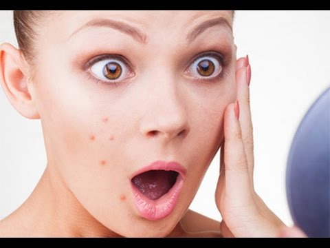 لايف ستايلشاهد: عادات تمارسها النساء كل يوم تسبب سرطان الثدي48904/0