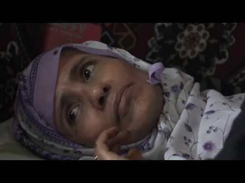 لايف ستايلشاهد: "صباح شريان" أرملة معاقة حركيًا منذ 18 عامًا48973/0