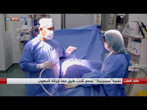 لايف ستايلشاهد: ابتكار تقنية جديدة وآمنة لشفط الدهون48974/0