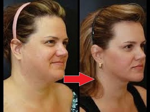 لايف ستايلاحصلي على وجه نحيف و خذود مرفوعة بهذه الخلطة السحرية المجربة 049251/0