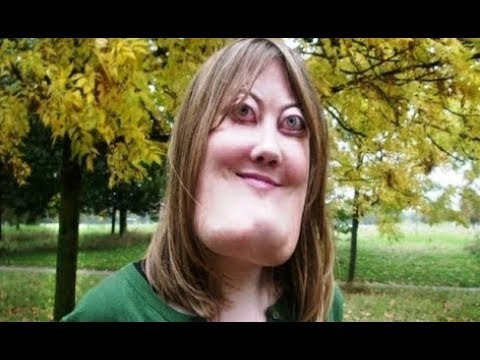 لايف ستايلشاهد: أغرب 10 نساء على مستوى العالم49650/0