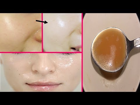 لايف ستايلوصفة رائعة للتخلص من البقع الداكنة49665/0