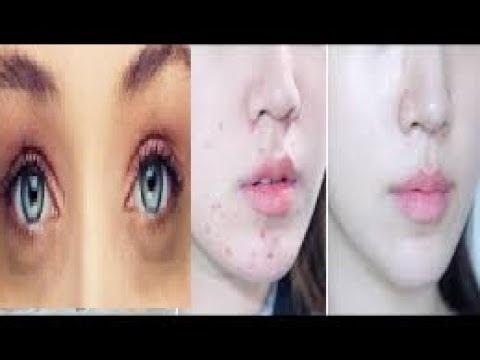 لايف ستايلشاهد: كيفية صنع صابونة الخيار لنضارة البشرة51061/0