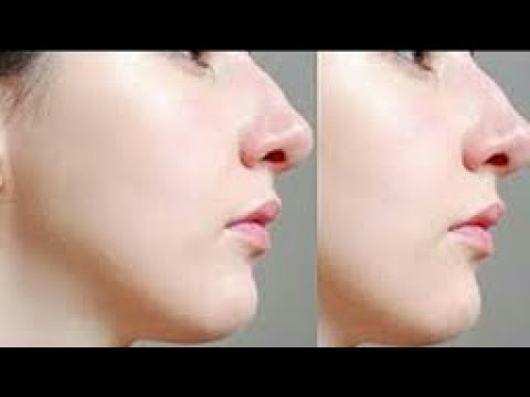 لايف ستايلشاهد: وصفة أميركية عجيبة لتصغير السن وشد البشرة51424/0