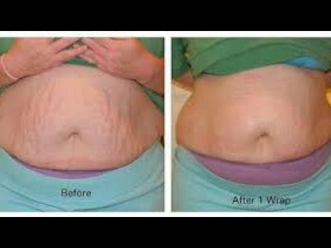 لايف ستايلشاهد: تخسيس البطن وإزالة الكرش خلال 5 أيام51428/0