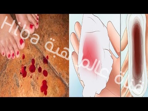 لايف ستايلشاهد: وصفة لمعالجة تاخر نزول الدورة الشهرية وتسهيل نزولها54938/0