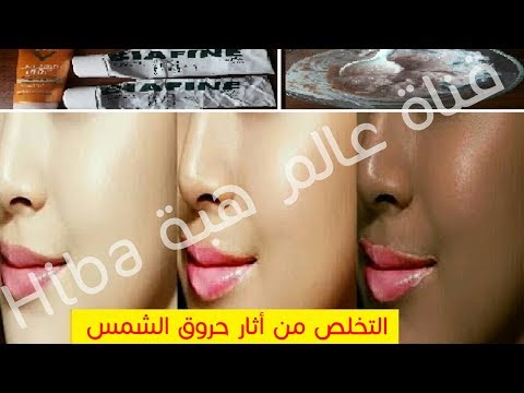 لايف ستايلشاهد: تبييض فوري للبشرة بعد التعرض لأشعة الشمس الحارقة في فصل الصيف54966/0