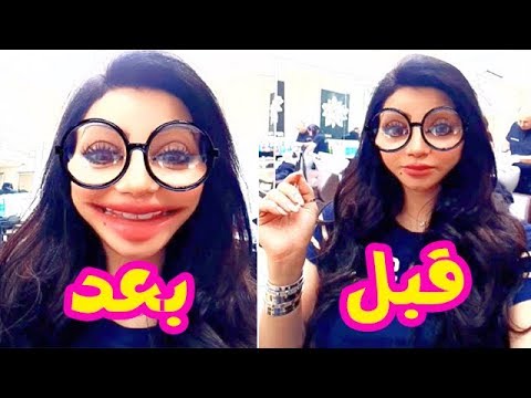 لايف ستايلشاهد: لجين عمران بعد عملية تكبير شفايفها55628/0