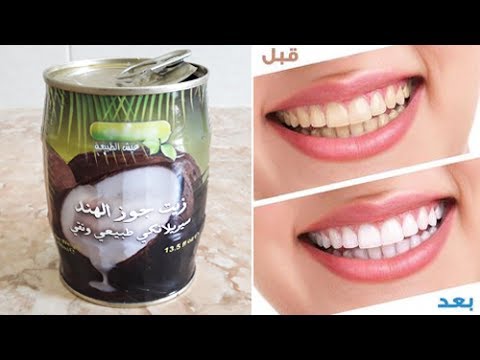 لايف ستايلزيت يساعد على معالجة رائحة الفم في رمضان56235/0