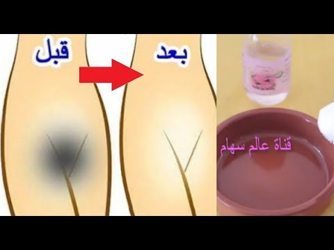 لايف ستايلشاهد: وصفة توضع على المنطقة الحساسة لمدة 30 دقيقة56262/0