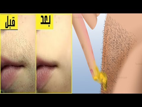 لايف ستايلشاهد: طريقة مذهلة لإزالة شعر المناطق الحساسة دون ألم56478/0