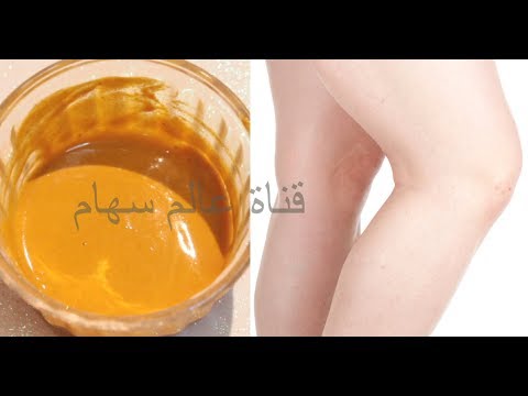 لايف ستايلتعرفي على طريقة بسيطة للتخلص من إسمرار الركبتين56917/0