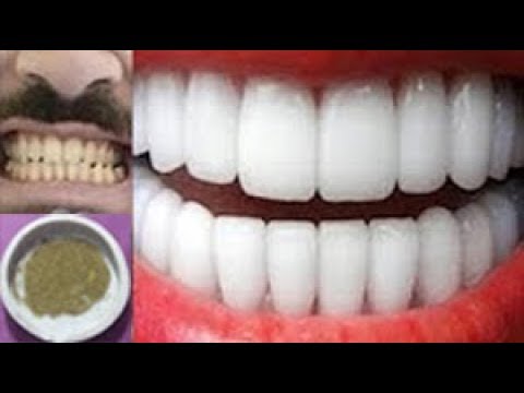 لايف ستايلتبييض الأسنان بخلطة طبيعية وصحية57098/0