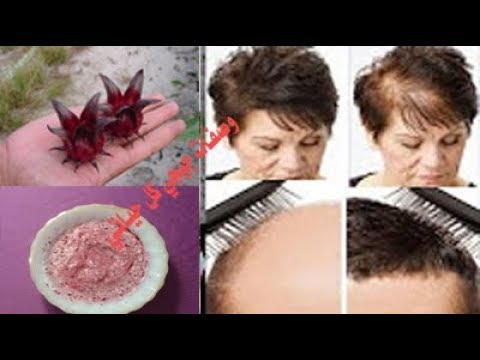 لايف ستايلتعرفي على نبات يعالج فراغات الشعر57105/0