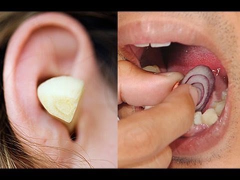 لايف ستايل5 أمراض يمكنك علاجها باستخدام البصل57476/0