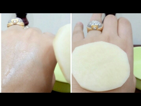 لايف ستايلشرائح البطاطس لمنطقة البيكينى والإبيطين57696/0