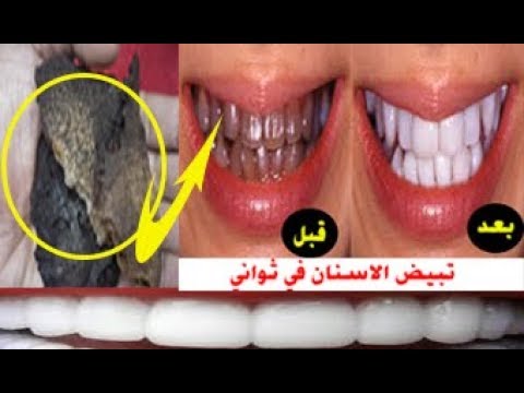 لايف ستايلشاهد: مسحة يابانية واحدة تخلصك من اصفرار الأسنان للأبد58510/0