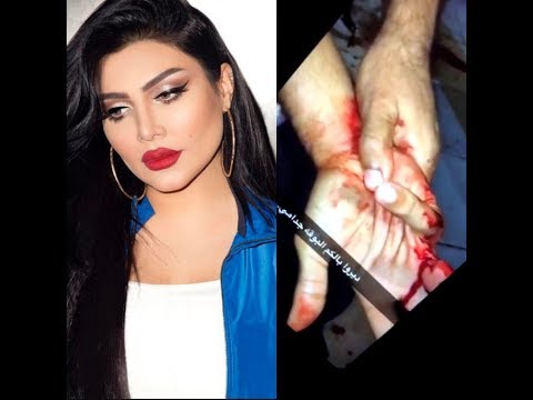 لايف ستايلشاهد: فنانة كويتية توثق لحظة سرقة سعودي في لندن بطريقة مروعة59498/0