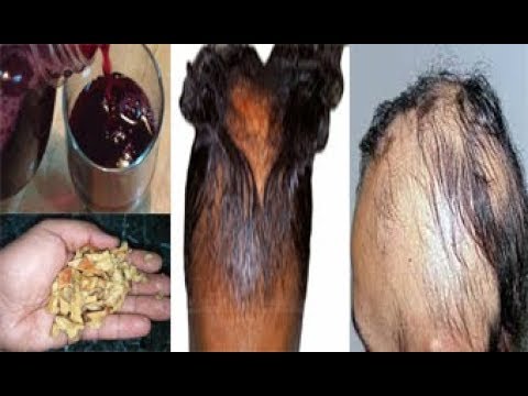 لايف ستايلشاهد: قشور الرمان لانبات الشعر وتكثيفة وعلاج الصلع والشيب59764/0