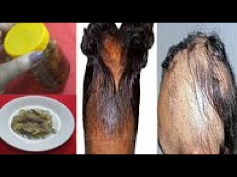 لايف ستايلبالفيديو: وصفة عجيبة لانبات الشعر وتقويته من جذوره59872/0