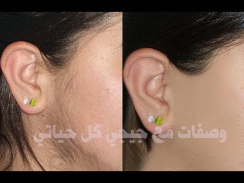 لايف ستايلبالفيديو: كيفية ازالة شعر الوجه والجسم كله بدون سويت59873/0