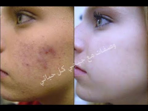 لايف ستايلشاهد| طريقة عمل مُقشر طبيعي دون مواد كميائية60352/0