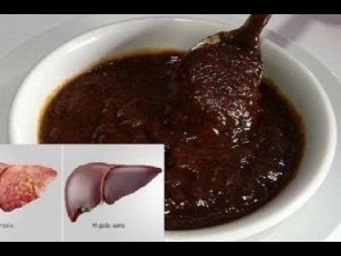 لايف ستايلشاهد: وصفة فعّالة لتطهير الكبد من السموم61033/0