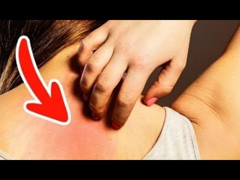 لايف ستايلشاهد: 7 علامات مبكرة تشير إلى مرض السرطان يتجاهلها الكثيرون61408/0