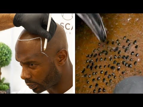 لايف ستايلشاهد: رجل بدون شعر يقرر رسم "تاتو"61447/0