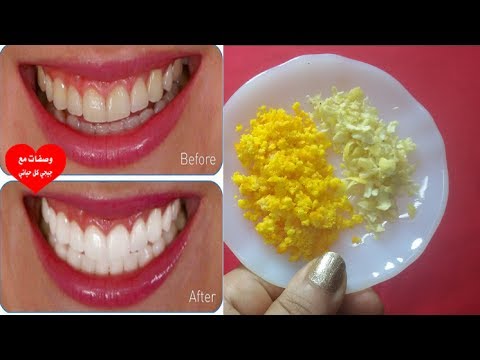 لايف ستايلطريقة إزالة الرواسب البكتيرية من باطن الأسنان61658/0