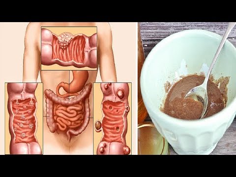 لايف ستايلشاهد: وصفة جديدة لتنظيف القولون نهائيًا من التراكمات61901/0