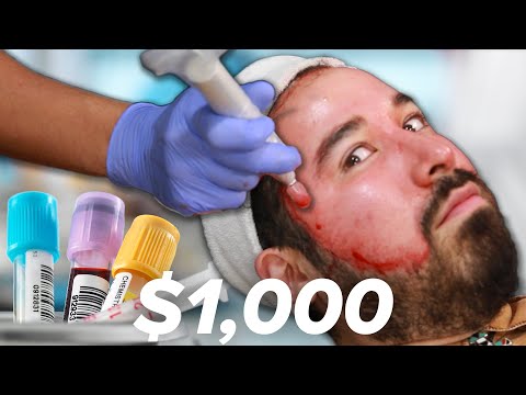 لايف ستايلماسك الدم أحدث طرق إزالة حب الشباب والبثور62325/0