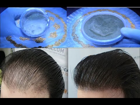 لايف ستايلبالفيديو: تعلمي عمل رغوة التكثيف 62483/0